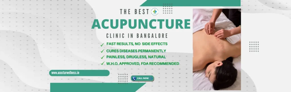 Acupuncture Treatment in Bangalore 