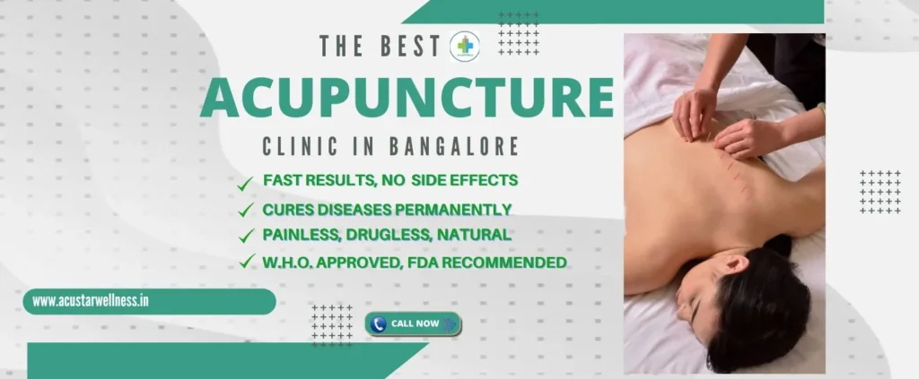 Acupuncture Therapy Near Me