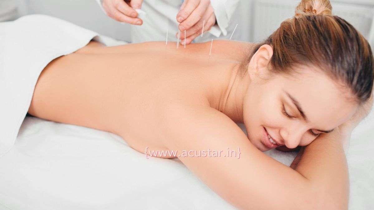 Best Acupuncture Clinic in BANGALORE
