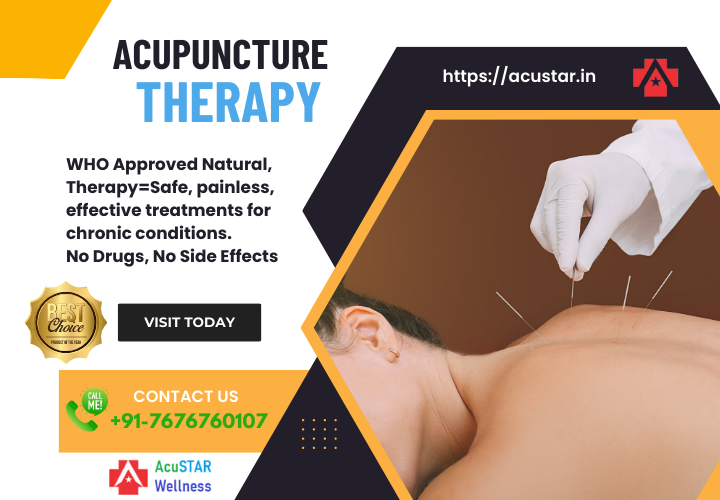 Acupuncture Therpay Near me in Bangalore